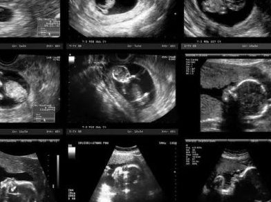 焦作地区有哪些私立的机构可以做试管技术？刚出生不久的婴儿睡觉姿势正确睡姿图有侧卧位这个姿势吗？