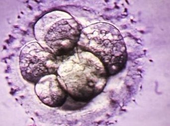 广东做试管婴儿的医院排名哪家好？附排名top10试管婴儿医院推荐！